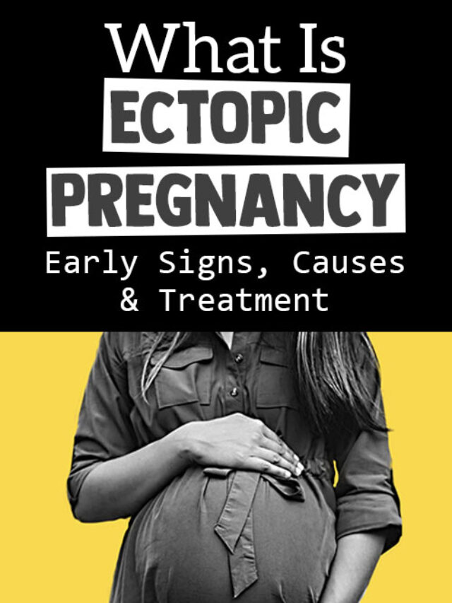 What is Ectopic Pregnancy Five Alarming Early Signs